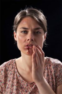 A woman with bruises and bloody lip
